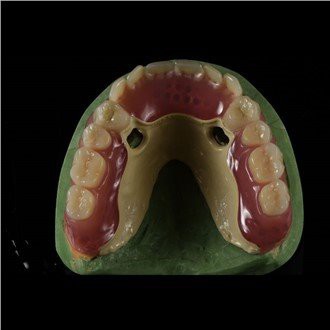 Пеек Фрамеворк Дентуре