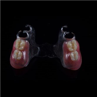 Делимична акрилна протеза која се може уклонити