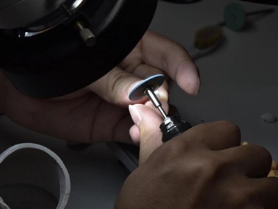 Колико дуго трају ПФМ круне? Просечан животни век, фактори и савети за негу